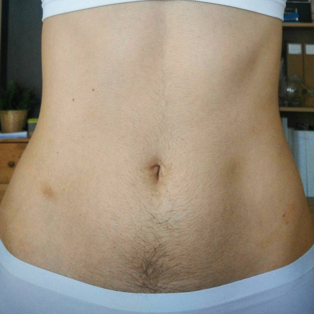 Hairy belly