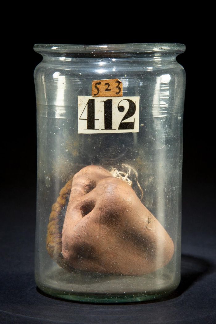 Протез носа, который голландец 18 века сделал для самого себя С миру по нитке