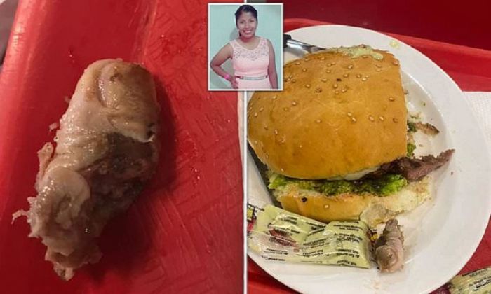 Женщина нашла в "великолепном гамбургере" палец. Его лишился сотрудник кафе С миру по нитке