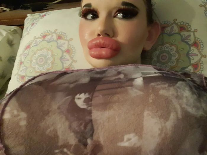 Болгарская студентка увеличит губы и скулы ради внешности как у куклы Bratz С миру по нитке