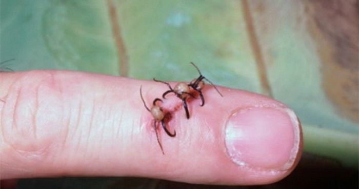 Как муравьёв используют в качестве хирургического шва С миру по нитке