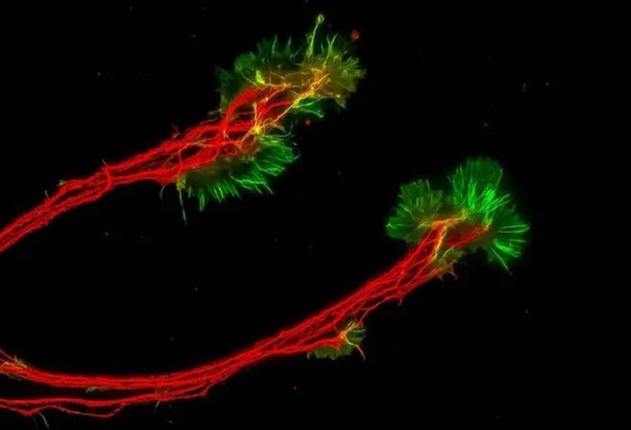 «Львиная грива»: гриб, который может помочь мозгу соединения, нейронов, новые, которые, грива, львиная, мозга, свойства, найти, Рамон, целью, подчеркивает, природные, могли, МартинесМармол, проникать, исследования, Ученые, Доктор, Альцгеймера