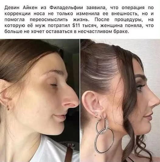 картинка 621ff03c95 000000